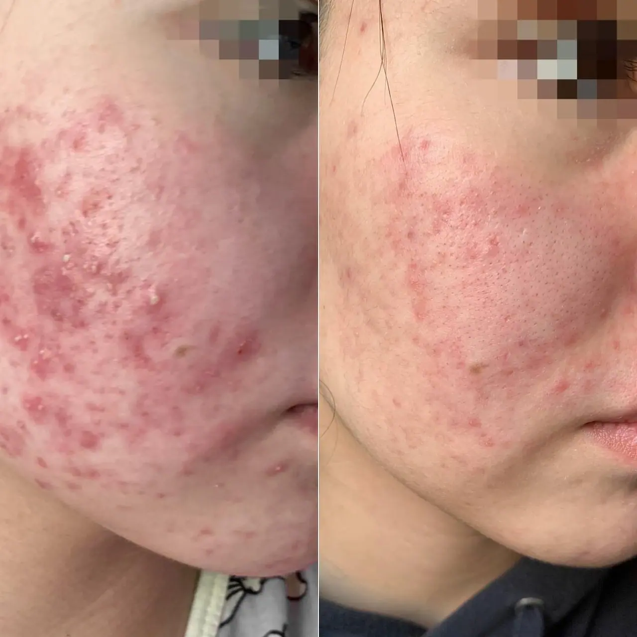 Уход за кожей лица для девочек-подростков: советы косметолога 5 whatsapp image 2025 04 13 at 18.55.16