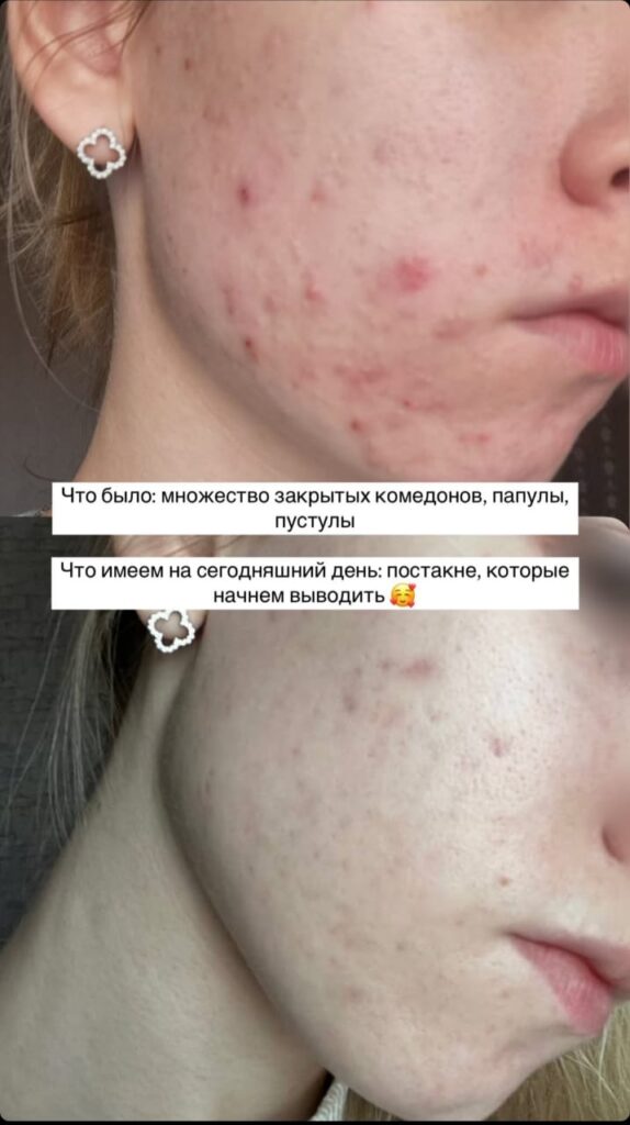 whatsapp image 2025 04 13 at 18.55.06 3